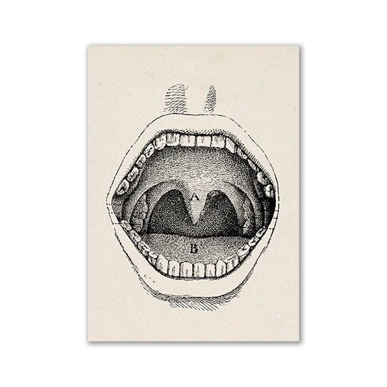 A black and white line drawing of an open human mouth showing teeth and gums labeled A and B.
