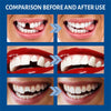 Comparison showing before and after use of a temporary tooth repair kit for gaps and fillings.
