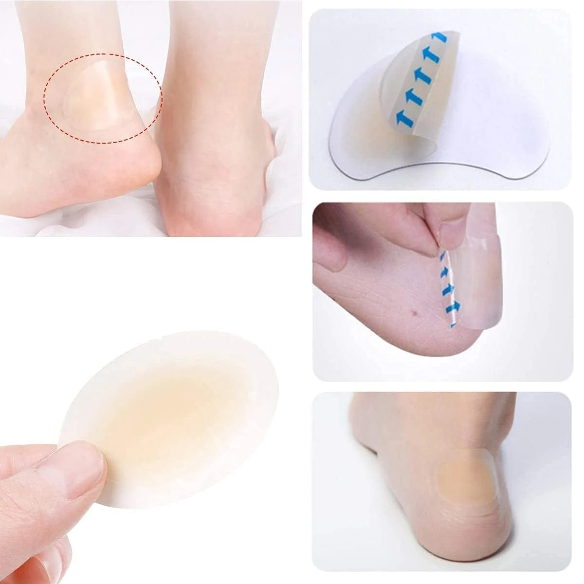 Various forms of hydrocolloid blister plasters and patches for skin protection shown on skin and in various applications.