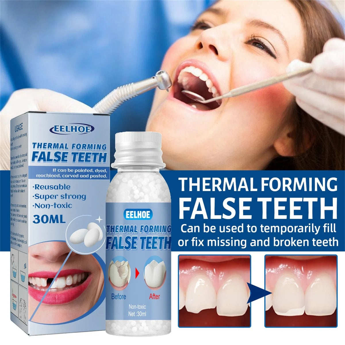 A woman is using a thermal forming false tooth product to repair missing or broken teeth.